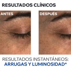 Age Absolu Contorno de Olhos