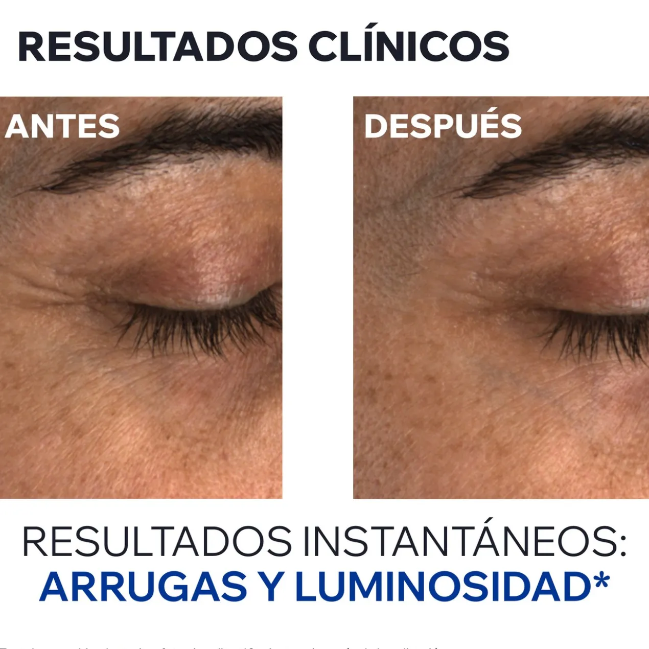 Age Absolu Contorno de Olhos