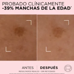 Age Perfect Sérum Corretor de Ação Rápida Antimanchas para Pele Madura