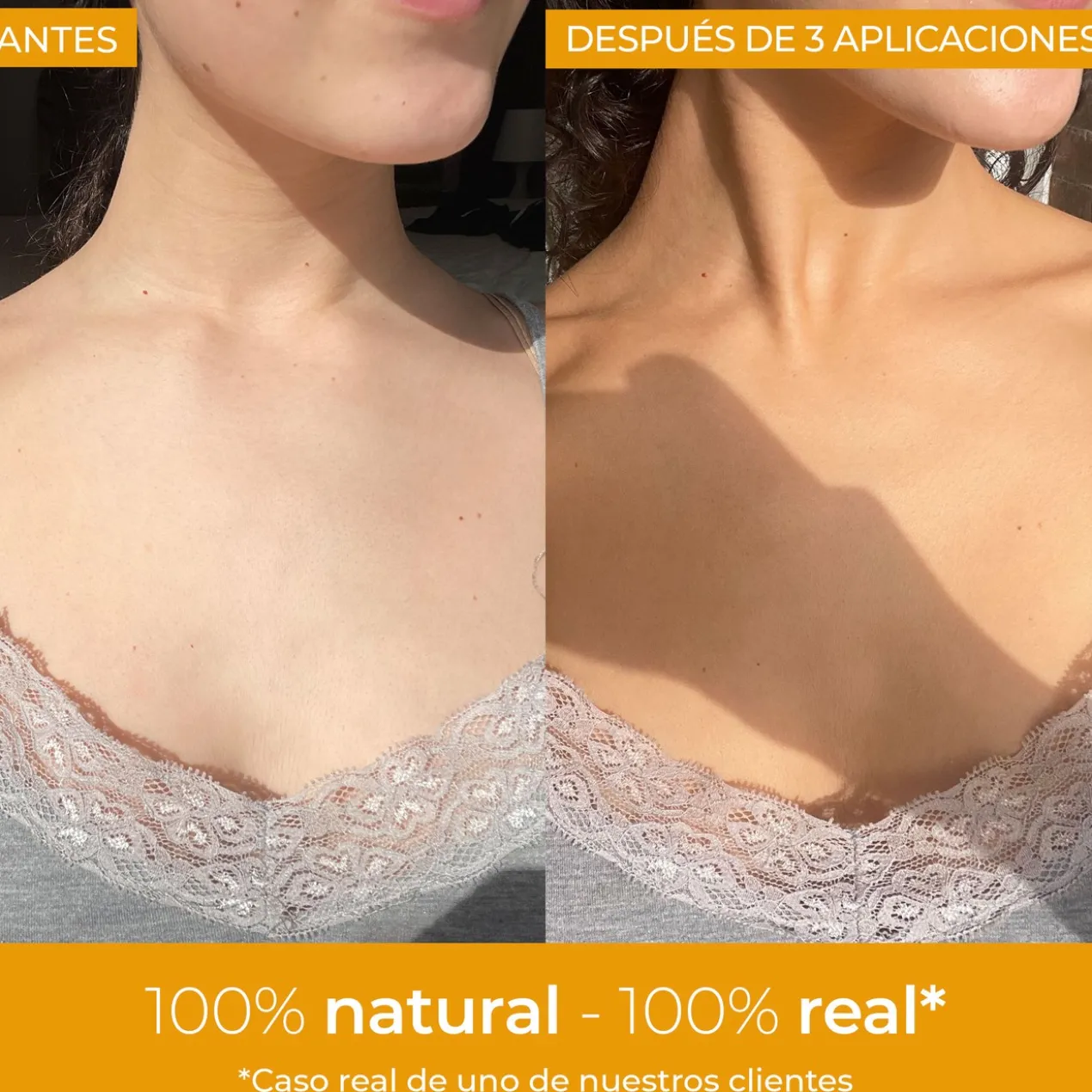 Autobronzeador Corporal