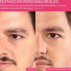 Beauty Concept Dermalift Silicone Patches Pensos Reutilizáveis