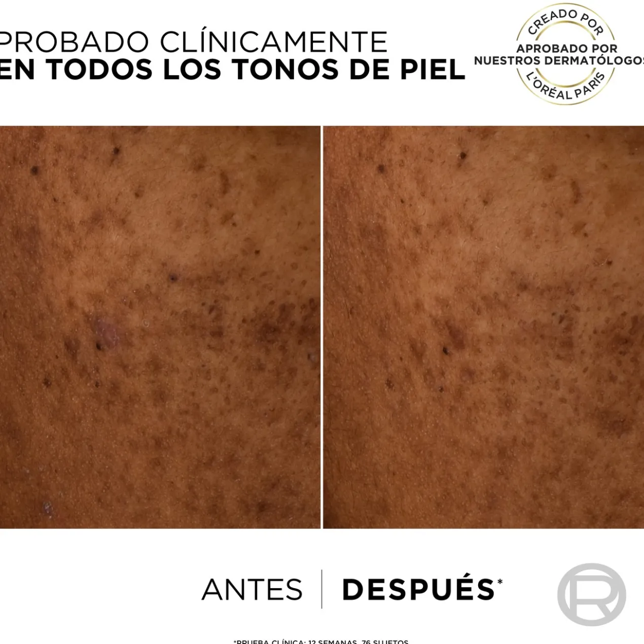 Bright Reveal Fluido Hidratante Anti-Manchas com Niacinamide SPF50+