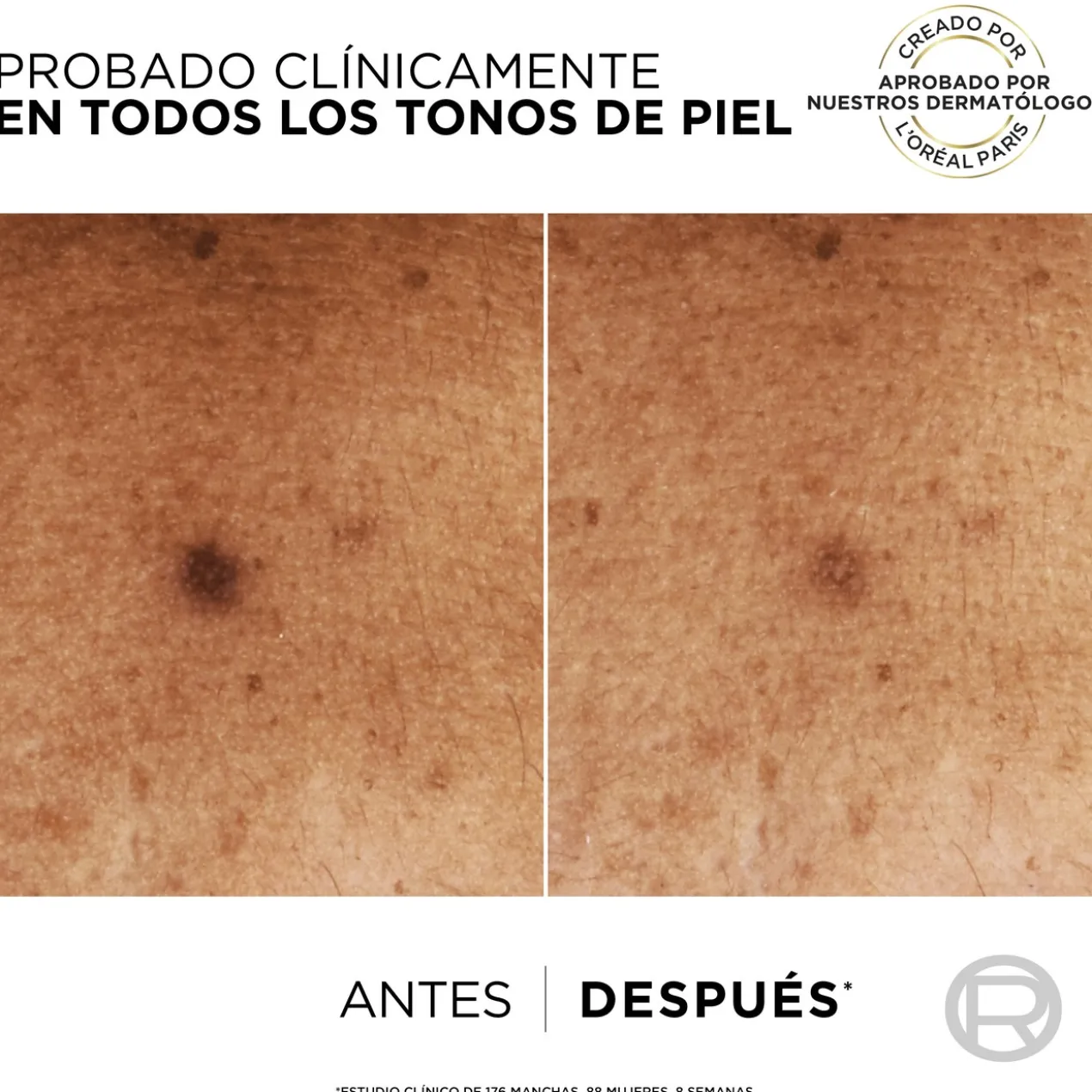 Bright Reveal Sérum Anti-Manchas com Niacinamida