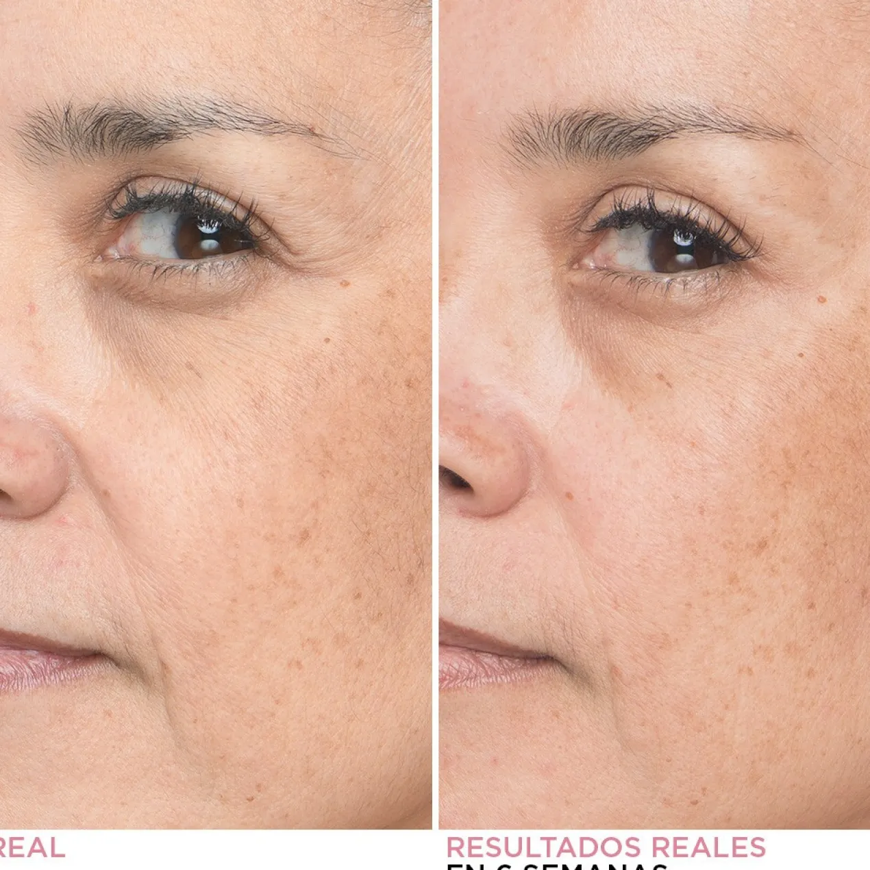 Bye Bye Lines Sérum Facial Redutor de Linhas de Expressão