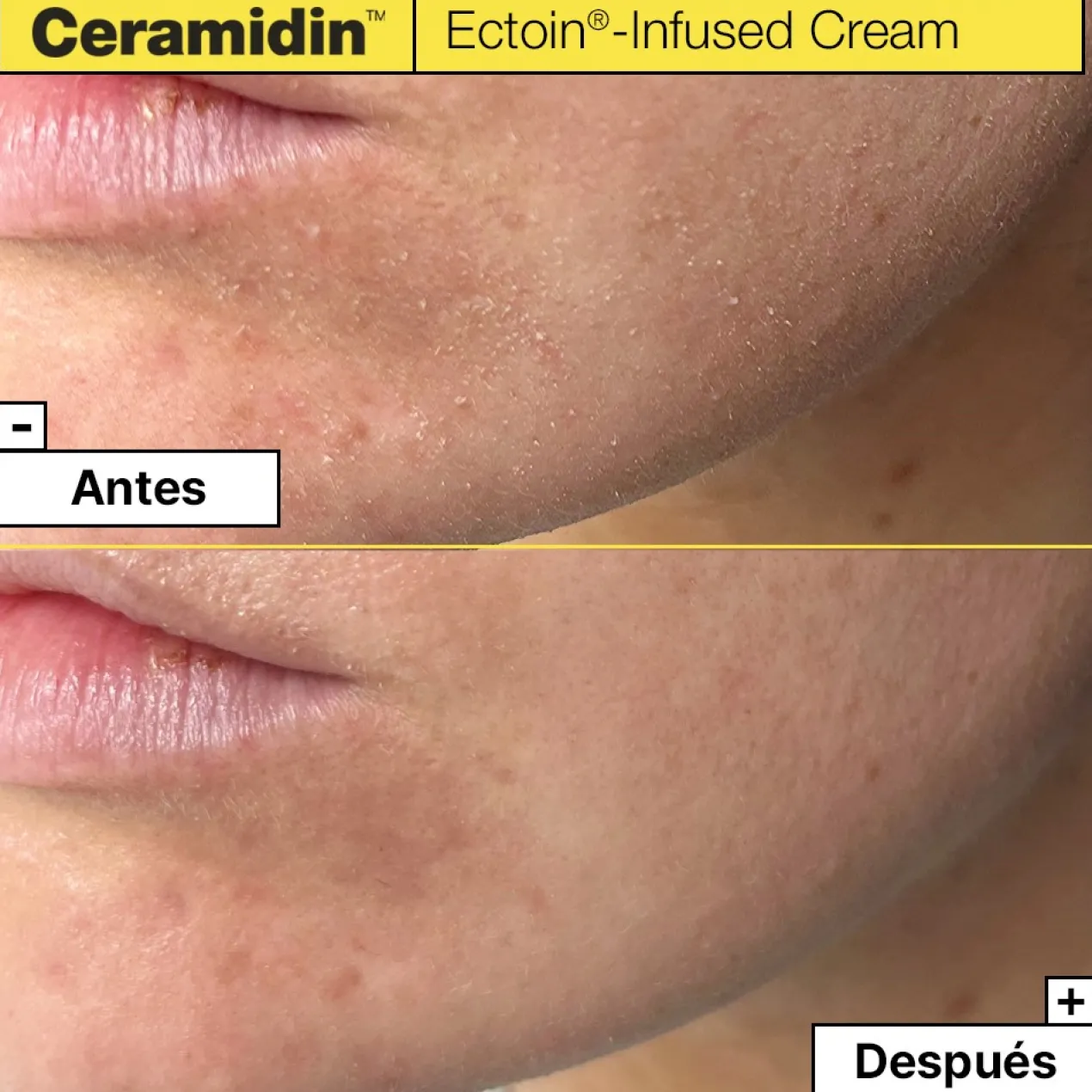 Ceramidin Creme com Ectoína