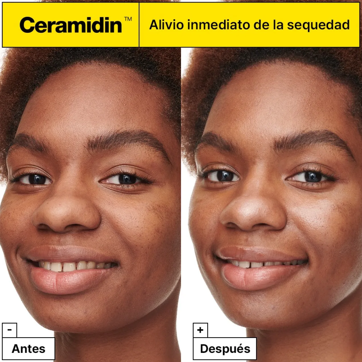Ceramidin Skin Barrier Moisturizing Cream