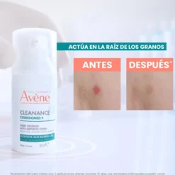 Cleanance Comedomed Concentrado Anti-imperfeições