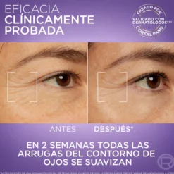 Contorno de Olhos Sérum Revitalift Filler 2,5% Ácido Hialurónico + Cafeína