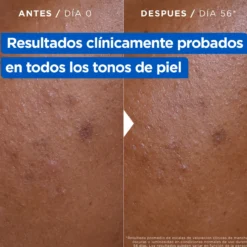 Creme Hidratante Antimanchas Niacidamide Bright