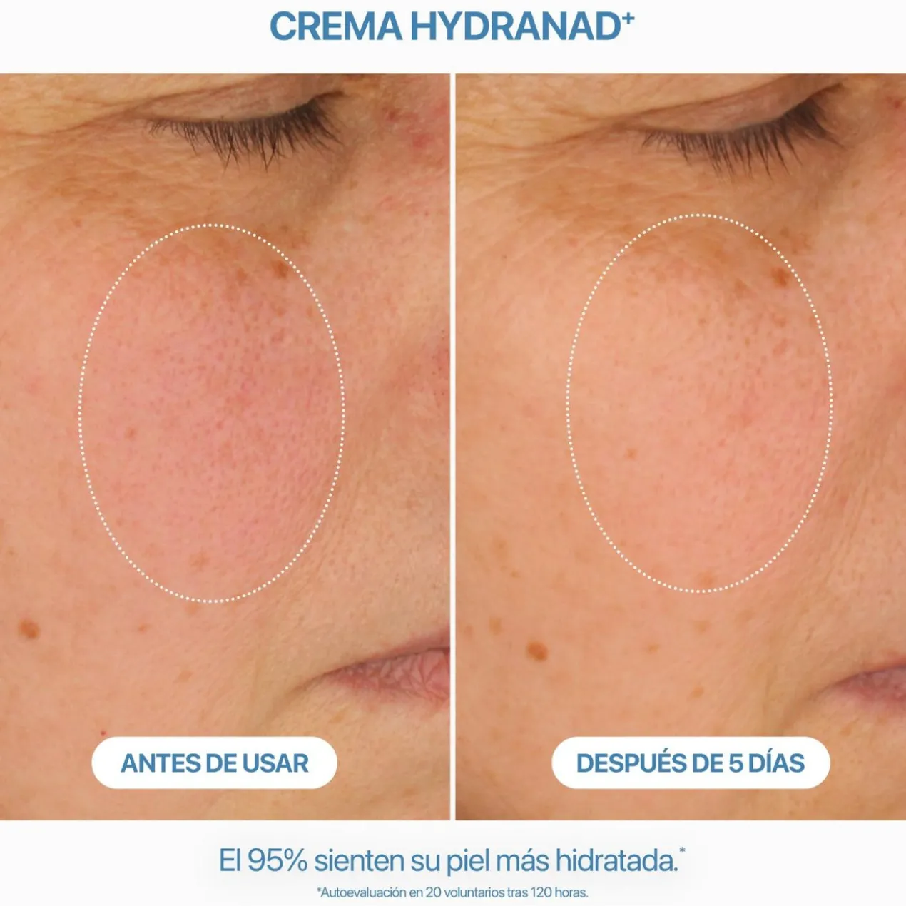 Creme Hydranad+