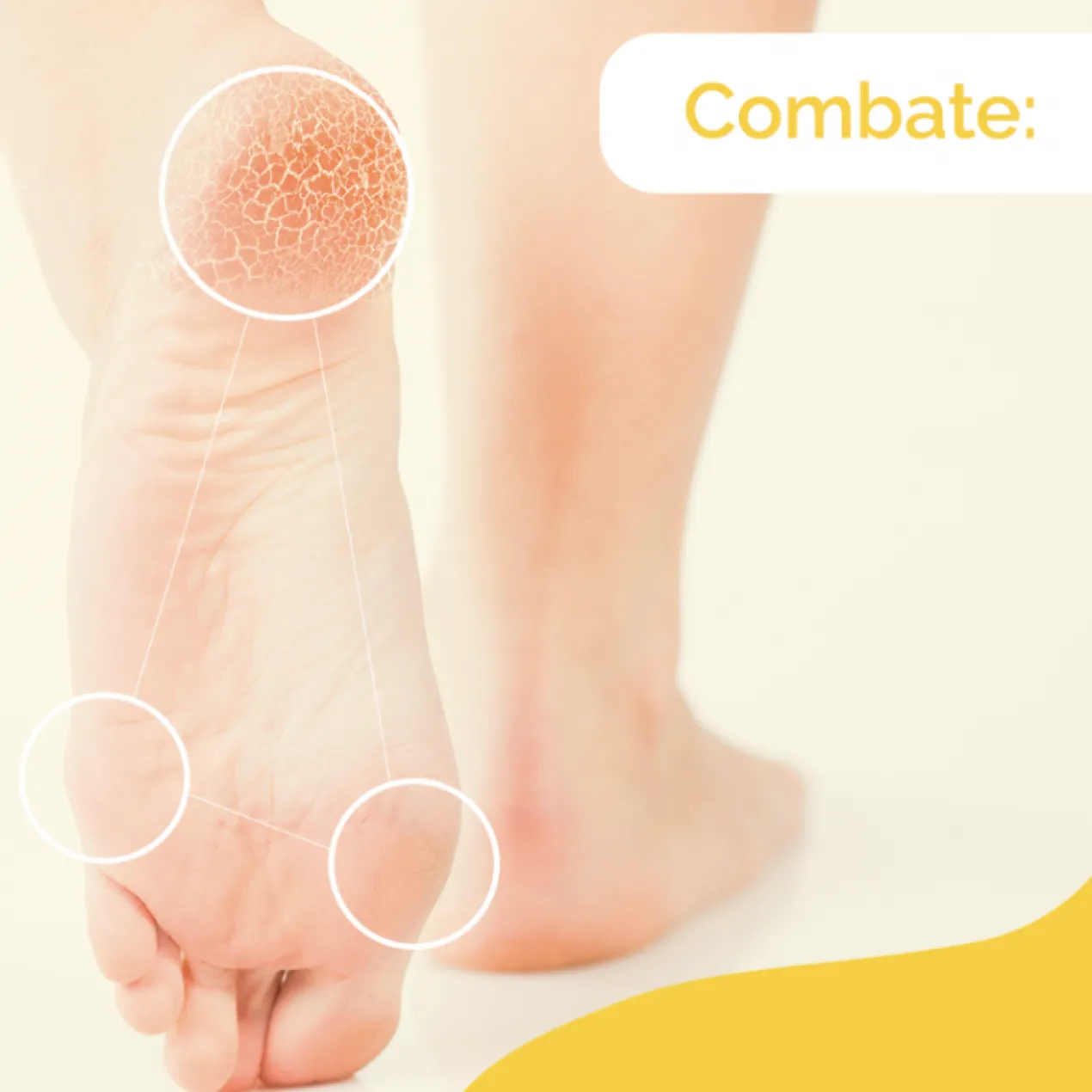 Creme para Pés com Calosidades