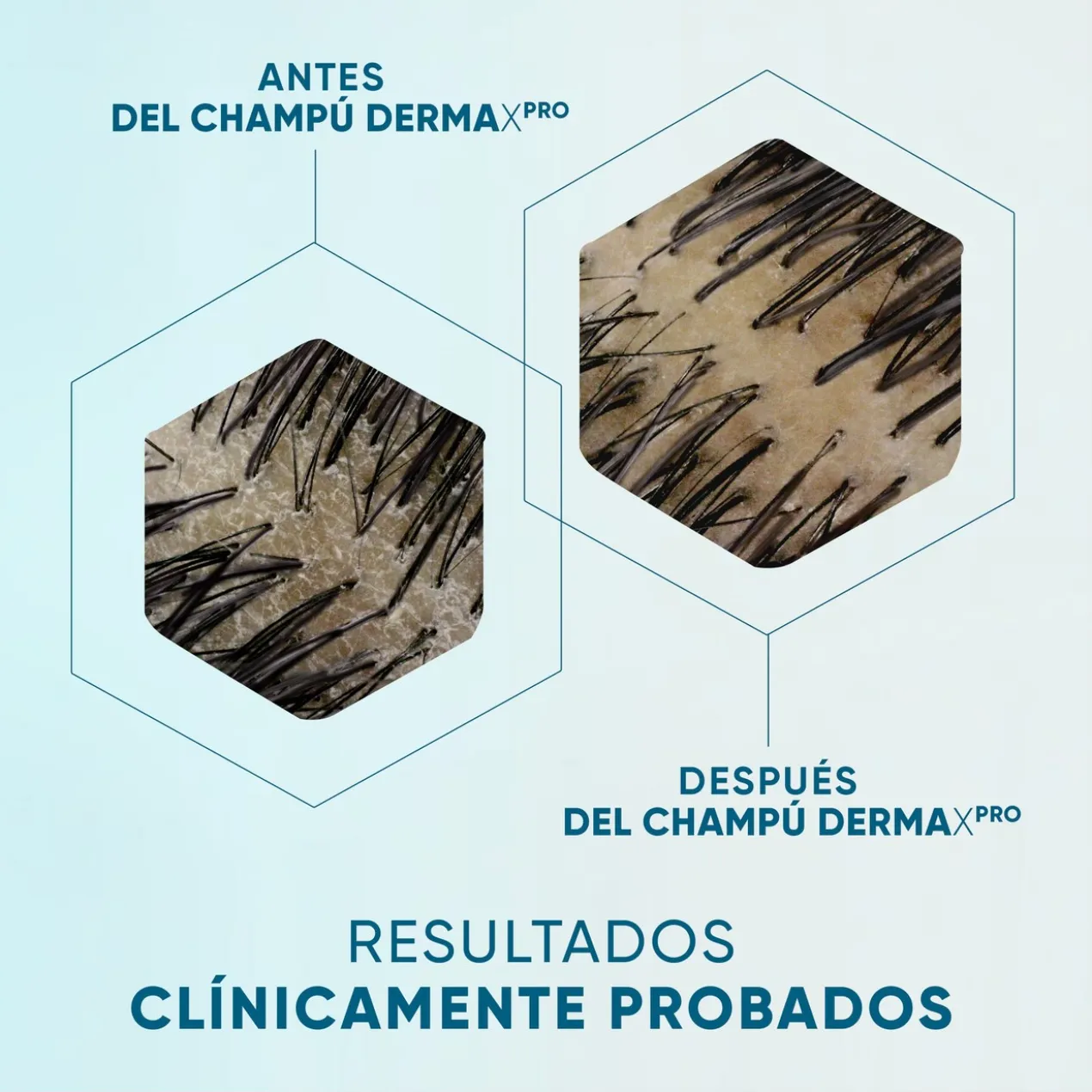 Dermaxpro Champô Calmante