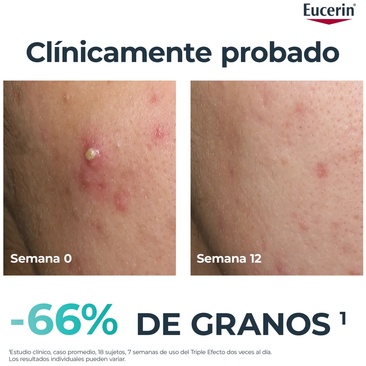 DermoPure Oil Control Sérum Efeito Triplo