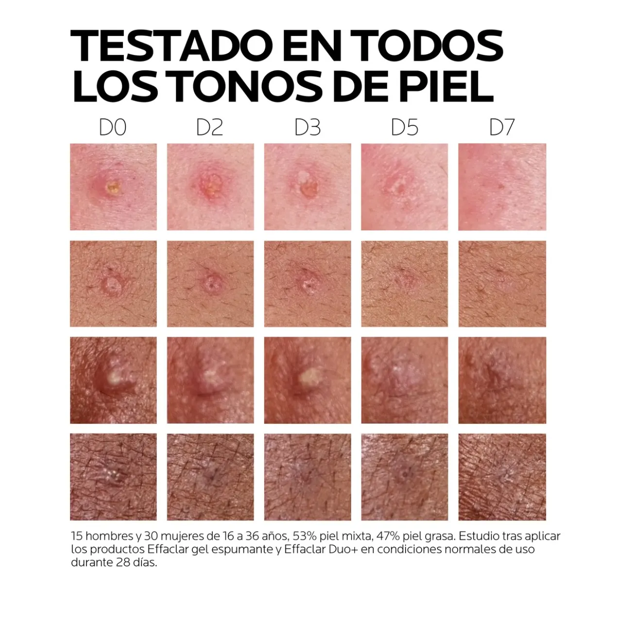 Effaclar Duo +M