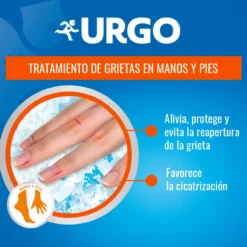Fissuras Filmogel