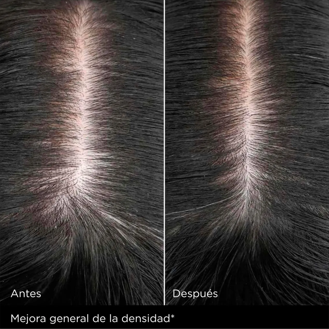Hair Therapy Le Serum