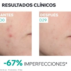 Hyseac Sérum Booster Anti-Imperfeições