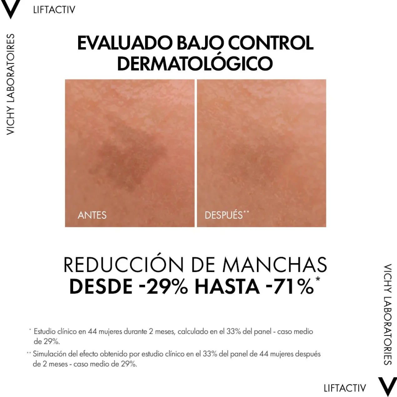 Liftactiv Pigment Specialist B3 Sérum Antimanchas