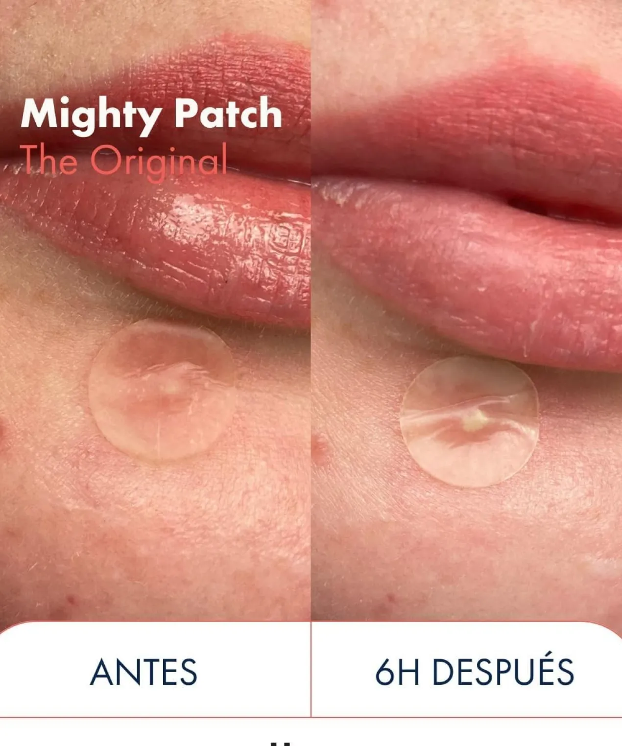 Mighty Patch Duo Patches de Hidrocoloide