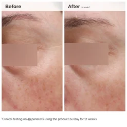Niacinamida 5% Emulsão para Rosto e Corpo