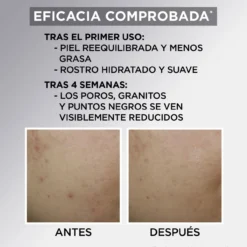 Pure Active Creme Hidratante Matificante com AHA + BHA com Carvão