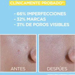 Pure Active Fluido UV com BHA + Niacinamida SPF50+