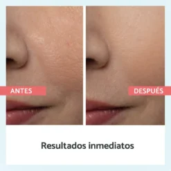 Redutor de Poros Instantâneo