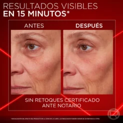 Revitalift Laser Corrector de Papos Instantâneo