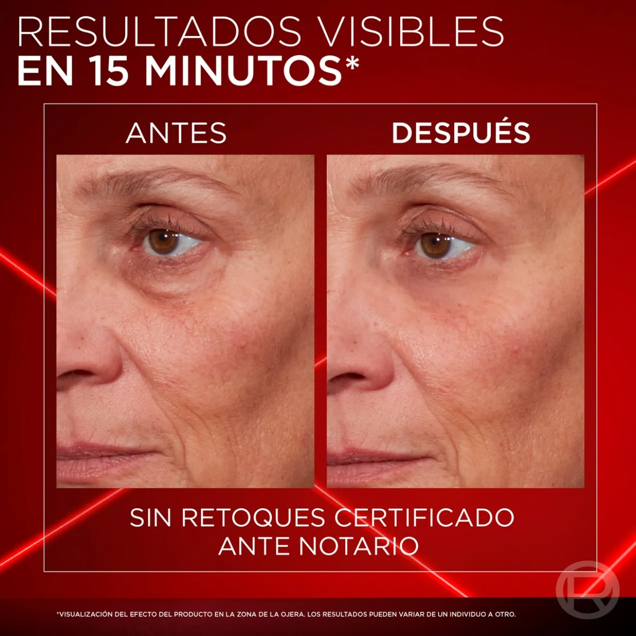 Revitalift Laser Corrector de Papos Instantâneo