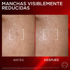 Revitalift Laser Sérum Antienvelhecimento