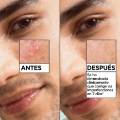Skin Active Sérum Salicílico Anti-imperfeições