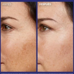 Sérum Antirrugas Noturno de Retinol Puro Revitalift Laser