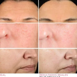 Sérum em Creme com Retinol Hello Results