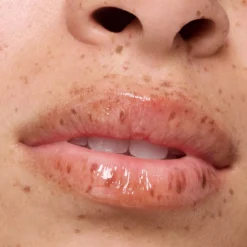 The Super Peptide Tratamento Labial