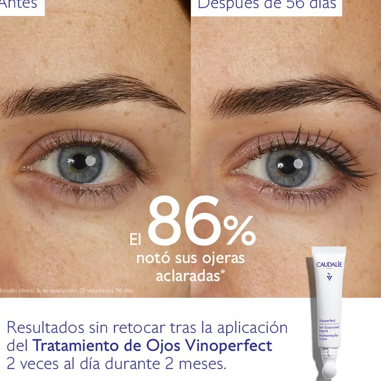 Vinoperfect Tratamento Iluminador de Olhos