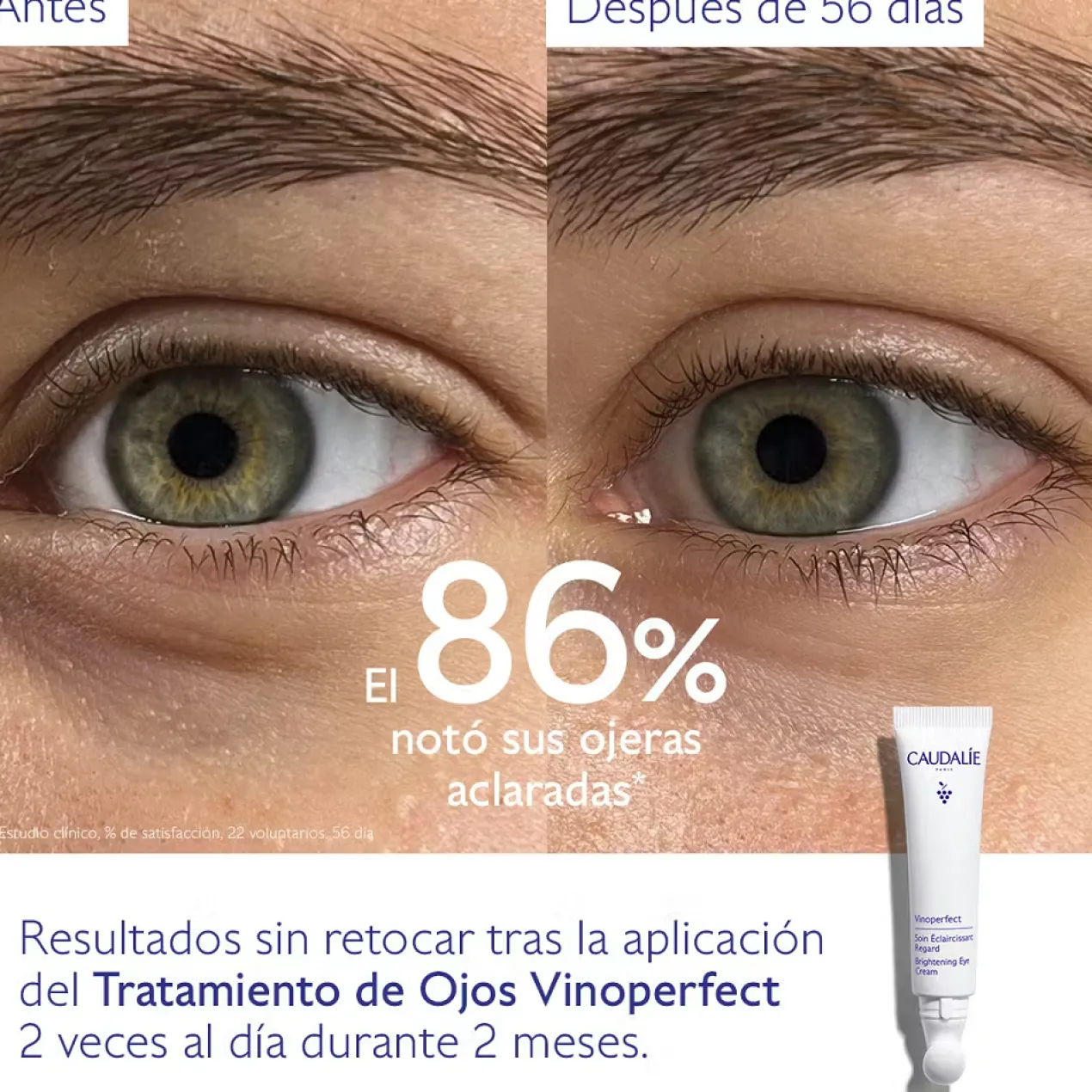 Vinoperfect Tratamento Iluminador de Olhos