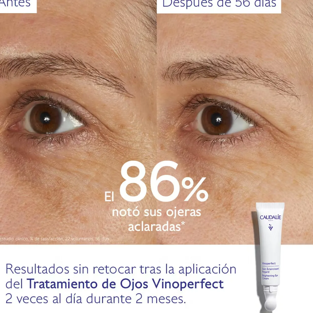 Vinoperfect Tratamento Iluminador de Olhos