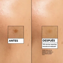 Vitamina C Sérum Antimanchas com 4% de [Niacinamida + Vitamina C + Ácido Salicílico + Melasyl]